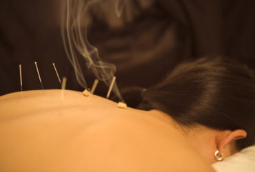 moxibustion-treatment-acupuncture moxibustion-treatment-acupuncture